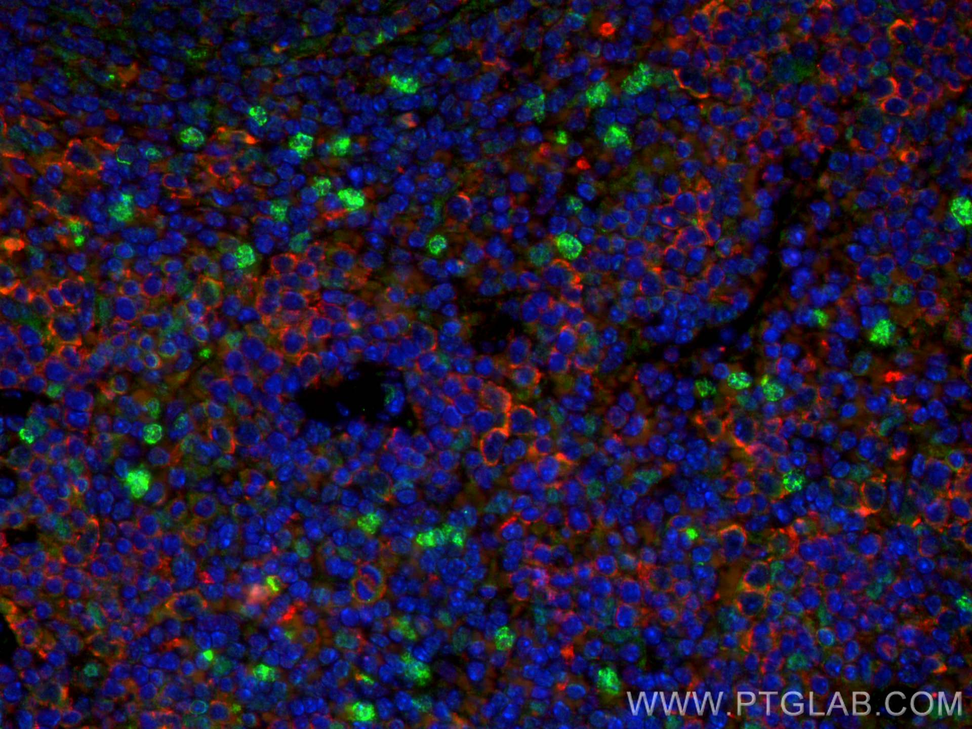 Immunofluorescence (IF) / fluorescent staining of mouse spleen tissue using CTLA-4/CD152 Polyclonal antibody (30648-1-AP)