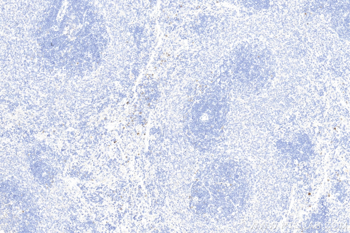 Immunohistochemistry (IHC) staining of rat spleen tissue using CTLA-4/CD152 Polyclonal antibody (30648-1-AP)