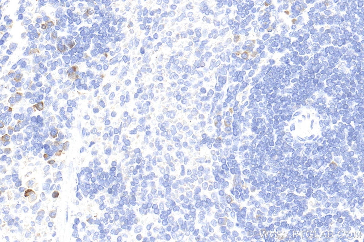 Immunohistochemistry (IHC) staining of rat spleen tissue using CTLA-4/CD152 Polyclonal antibody (30648-1-AP)