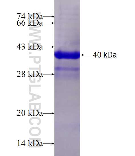 CTLA-4 fusion protein Ag28226 SDS-PAGE