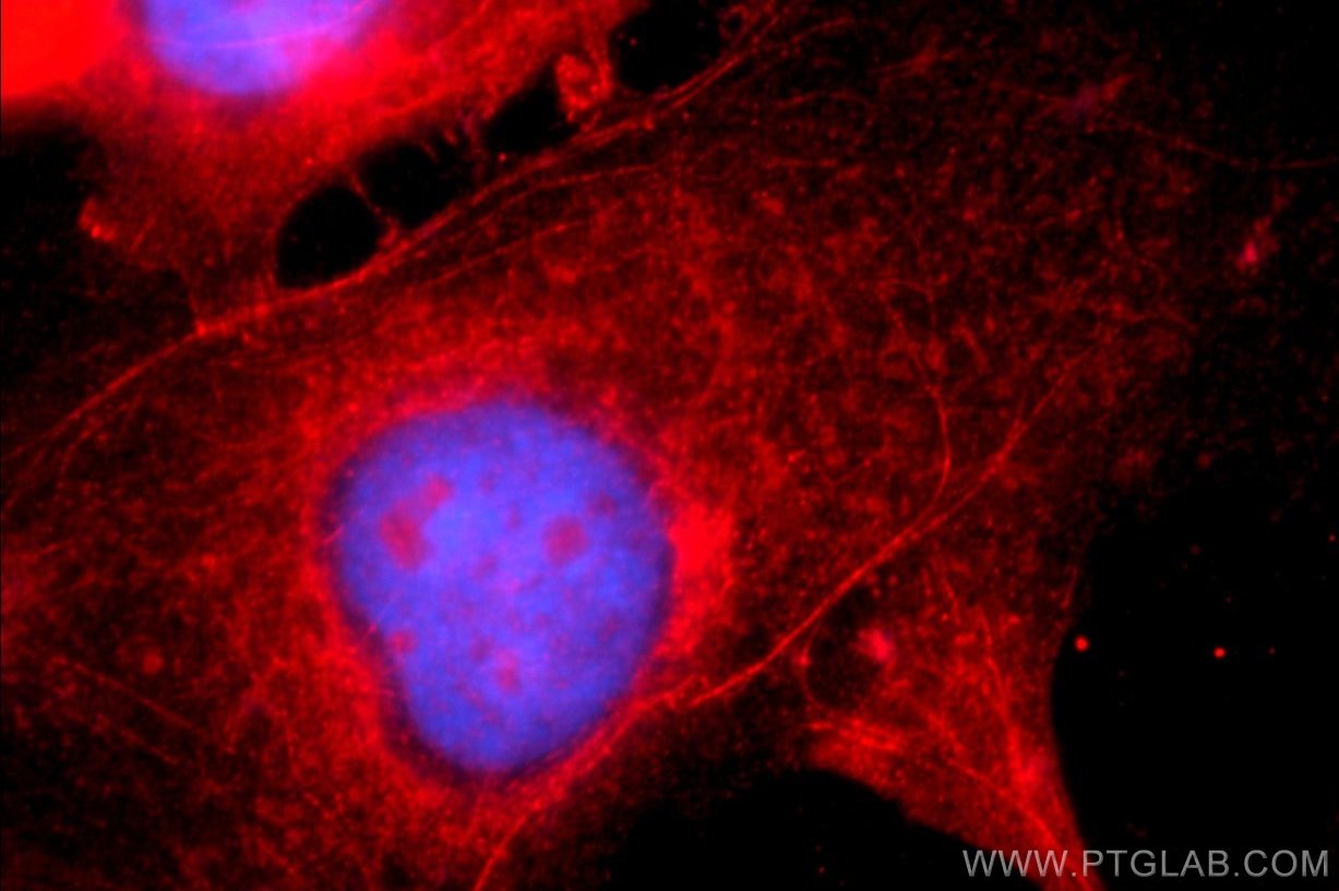 Immunofluorescence (IF) / fluorescent staining of A431 cells using Alpha E-Catenin Polyclonal antibody (12831-1-AP)
