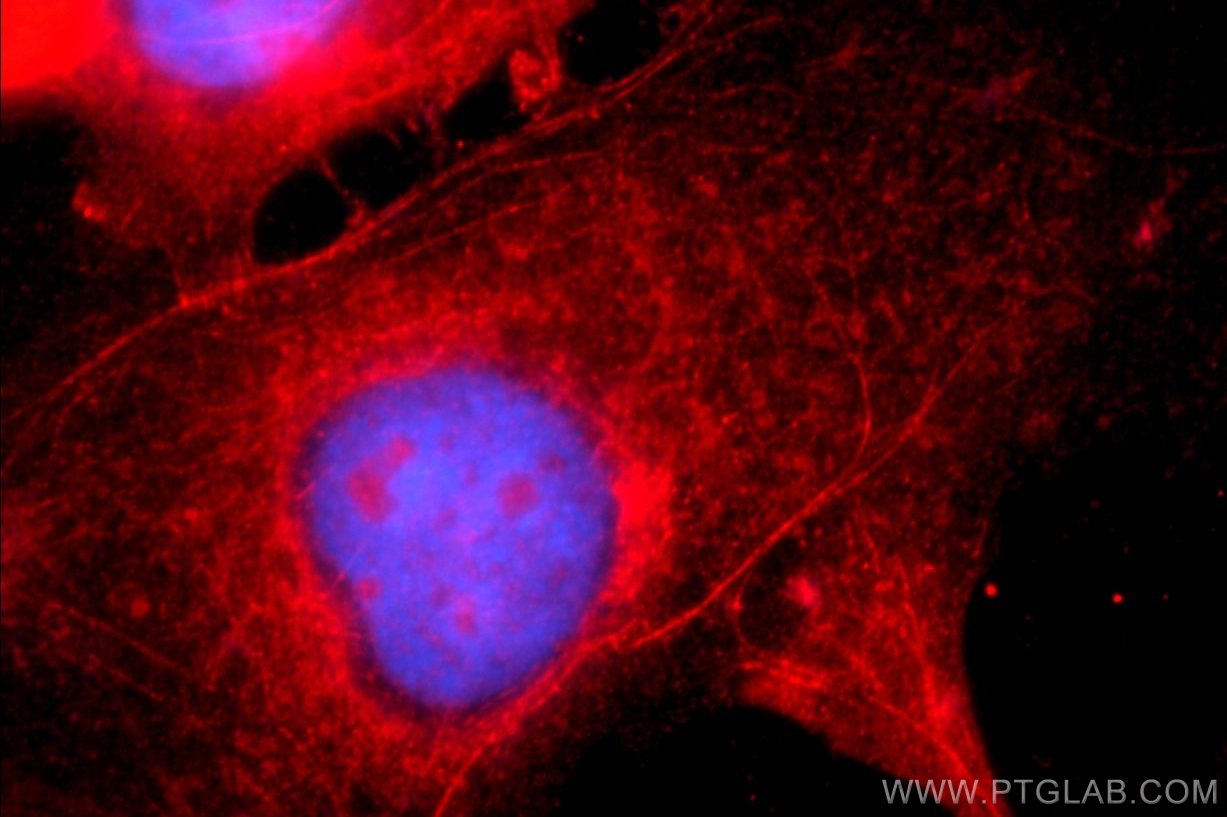 IF Staining of A431 using 12831-1-AP