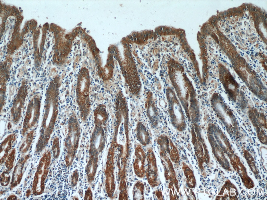 Immunohistochemistry (IHC) staining of human stomach tissue using Alpha E-Catenin Polyclonal antibody (12831-1-AP)