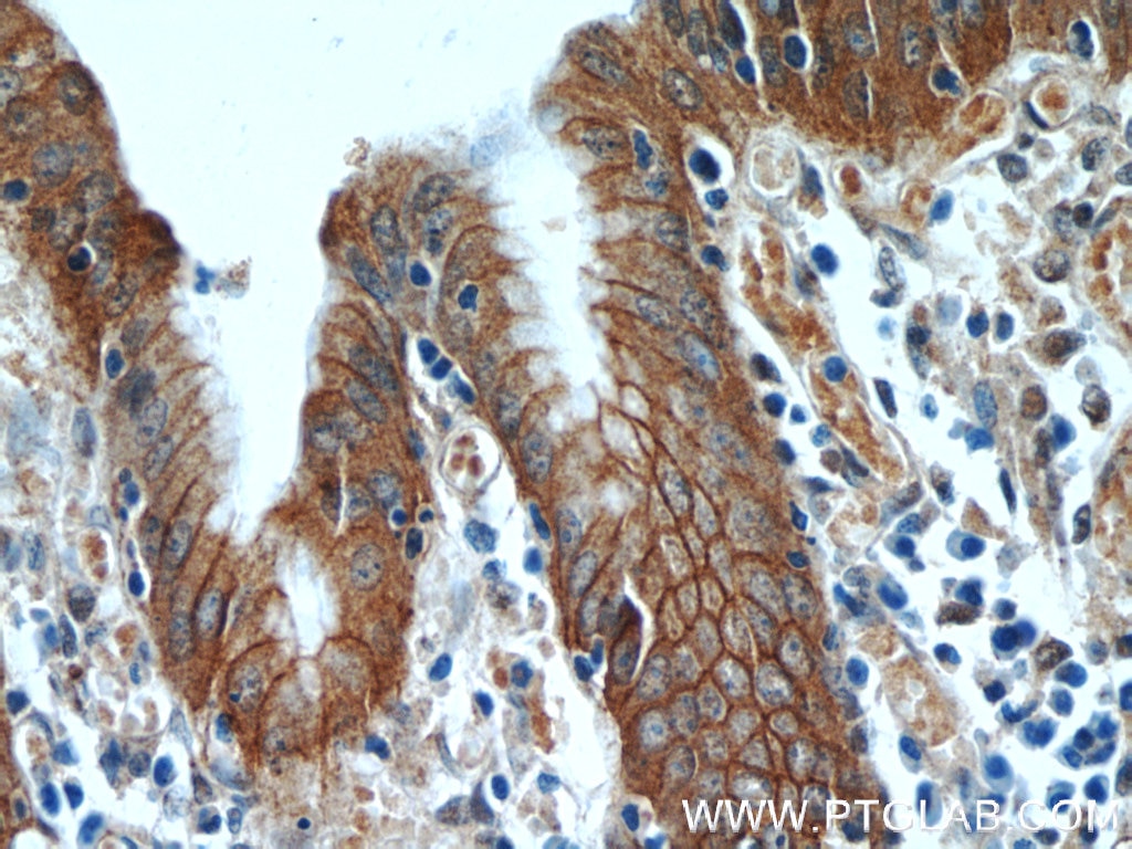 Immunohistochemistry (IHC) staining of human stomach tissue using Alpha E-Catenin Polyclonal antibody (12831-1-AP)