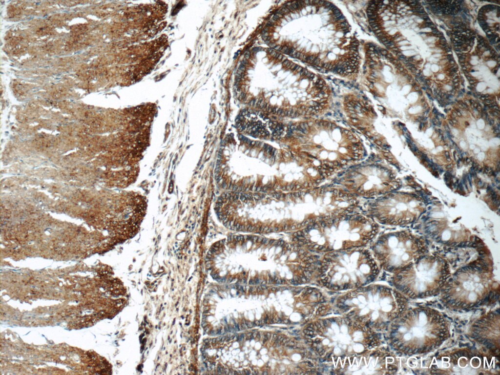 IHC staining of human colon using 12831-1-AP