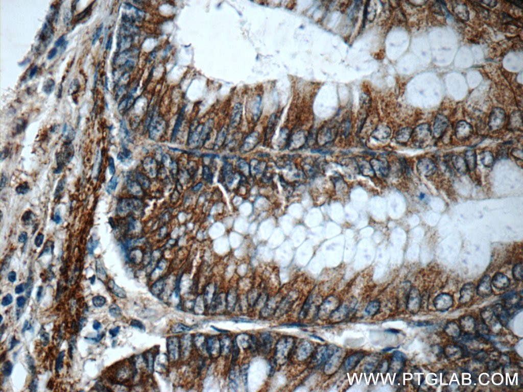 Immunohistochemistry (IHC) staining of human colon tissue using Alpha E-Catenin Polyclonal antibody (12831-1-AP)