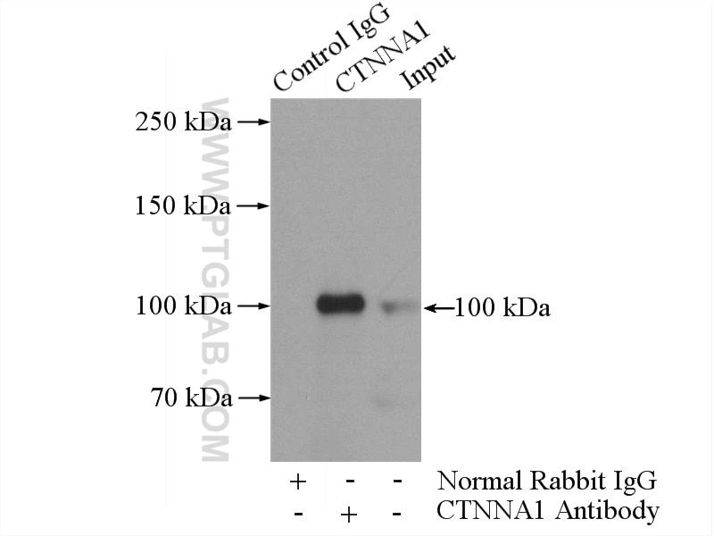 Immunoprecipitation (IP) experiment of mouse brain tissue using Alpha E-Catenin Polyclonal antibody (12831-1-AP)