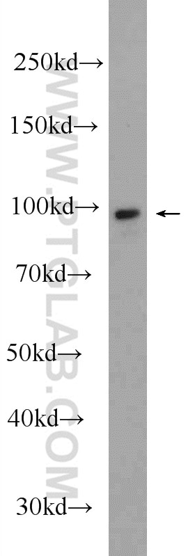 Western Blot (WB) analysis of mouse uterus tissue using Alpha E-Catenin Polyclonal antibody (12831-1-AP)