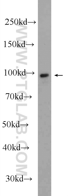 WB analysis of mouse uterus using 12831-1-AP