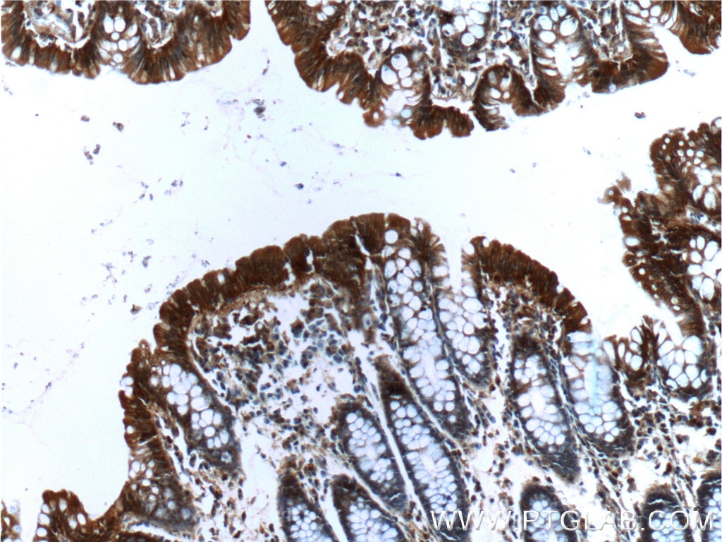 Immunohistochemistry (IHC) staining of human colon tissue using Alpha E-Catenin Monoclonal antibody (66221-1-Ig)