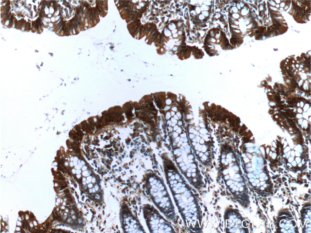 IHC staining of human colon using 66221-1-Ig