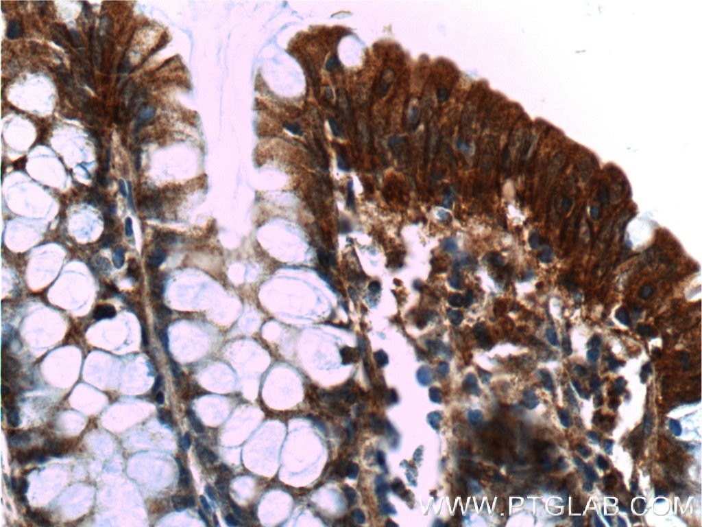 Immunohistochemistry (IHC) staining of human colon tissue using Alpha E-Catenin Monoclonal antibody (66221-1-Ig)