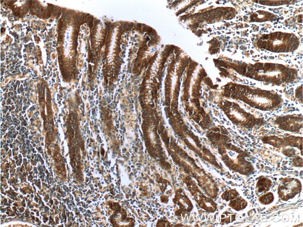 Immunohistochemistry (IHC) staining of human stomach tissue using Alpha E-Catenin Monoclonal antibody (66221-1-Ig)