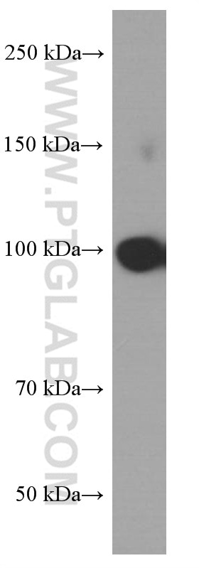 Western Blot (WB) analysis of NIH/3T3 cells using Alpha E-Catenin Monoclonal antibody (66221-1-Ig)