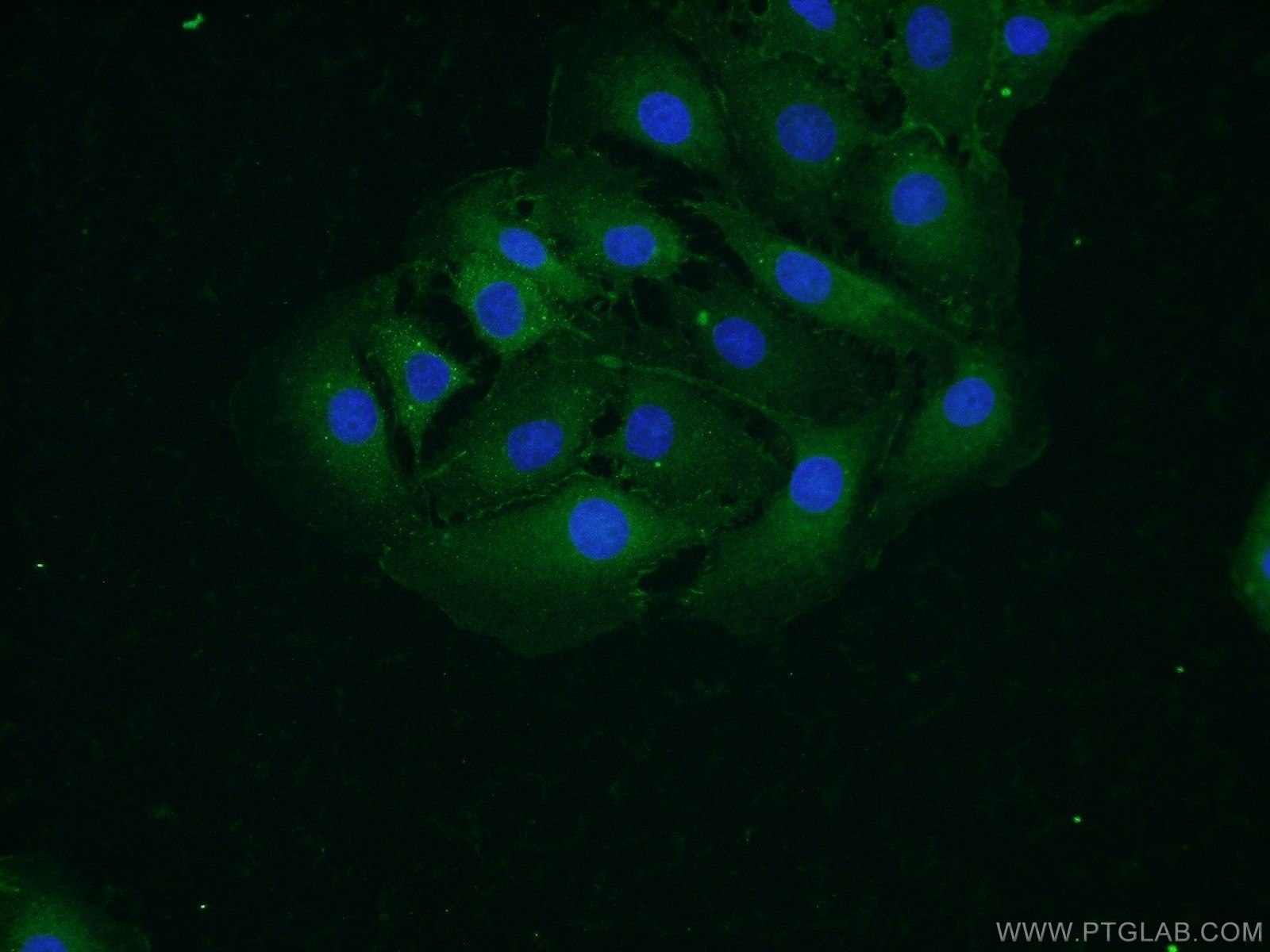 Immunofluorescence (IF) / fluorescent staining of SH-SY5Y cells using Alpha N-Catenin Polyclonal antibody (14362-1-AP)