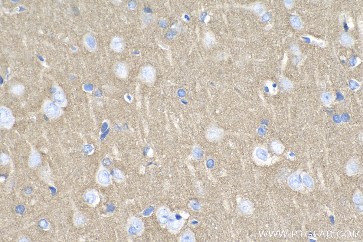 IHC staining of rat brain using 14362-1-AP