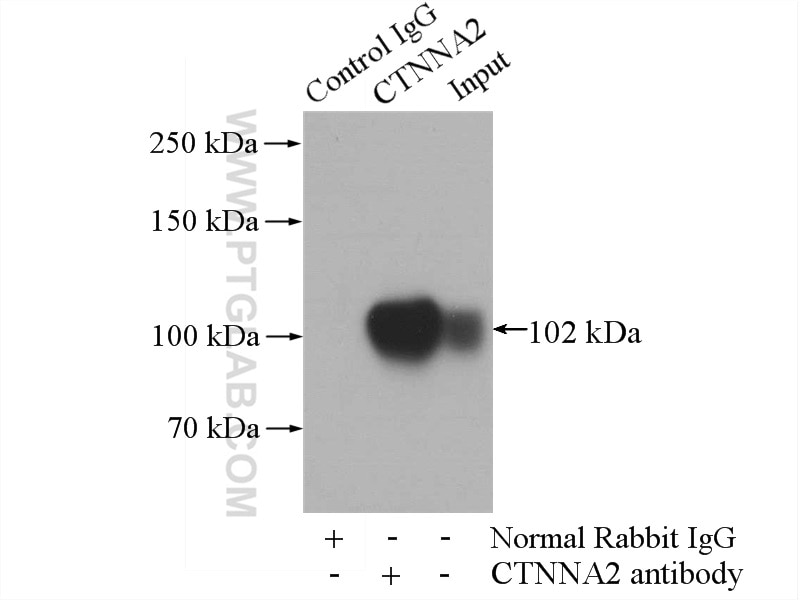 Immunoprecipitation (IP) experiment of SH-SY5Y cells using Alpha N-Catenin Polyclonal antibody (14362-1-AP)
