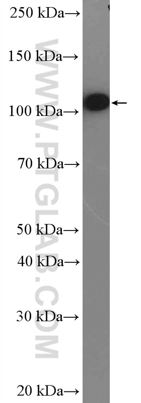 Western Blot (WB) analysis of SH-SY5Y cells using Alpha N-Catenin Polyclonal antibody (14362-1-AP)