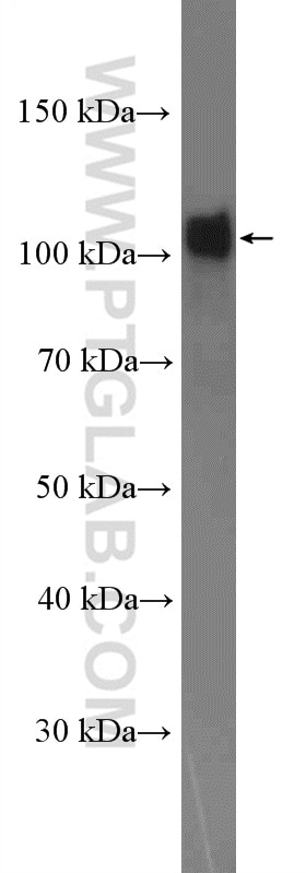 Western Blot (WB) analysis of mouse pancreas tissue using Alpha N-Catenin Polyclonal antibody (14362-1-AP)