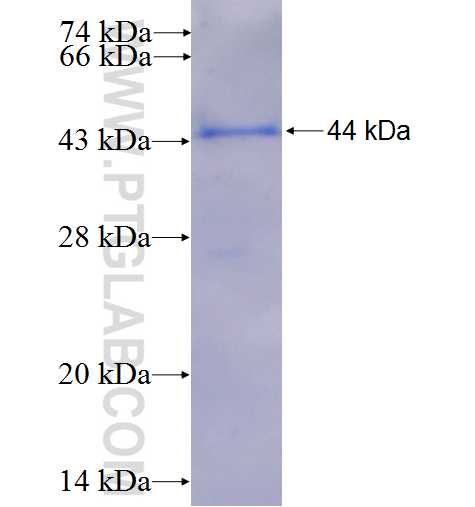 CTNNA2 fusion protein Ag5825 SDS-PAGE