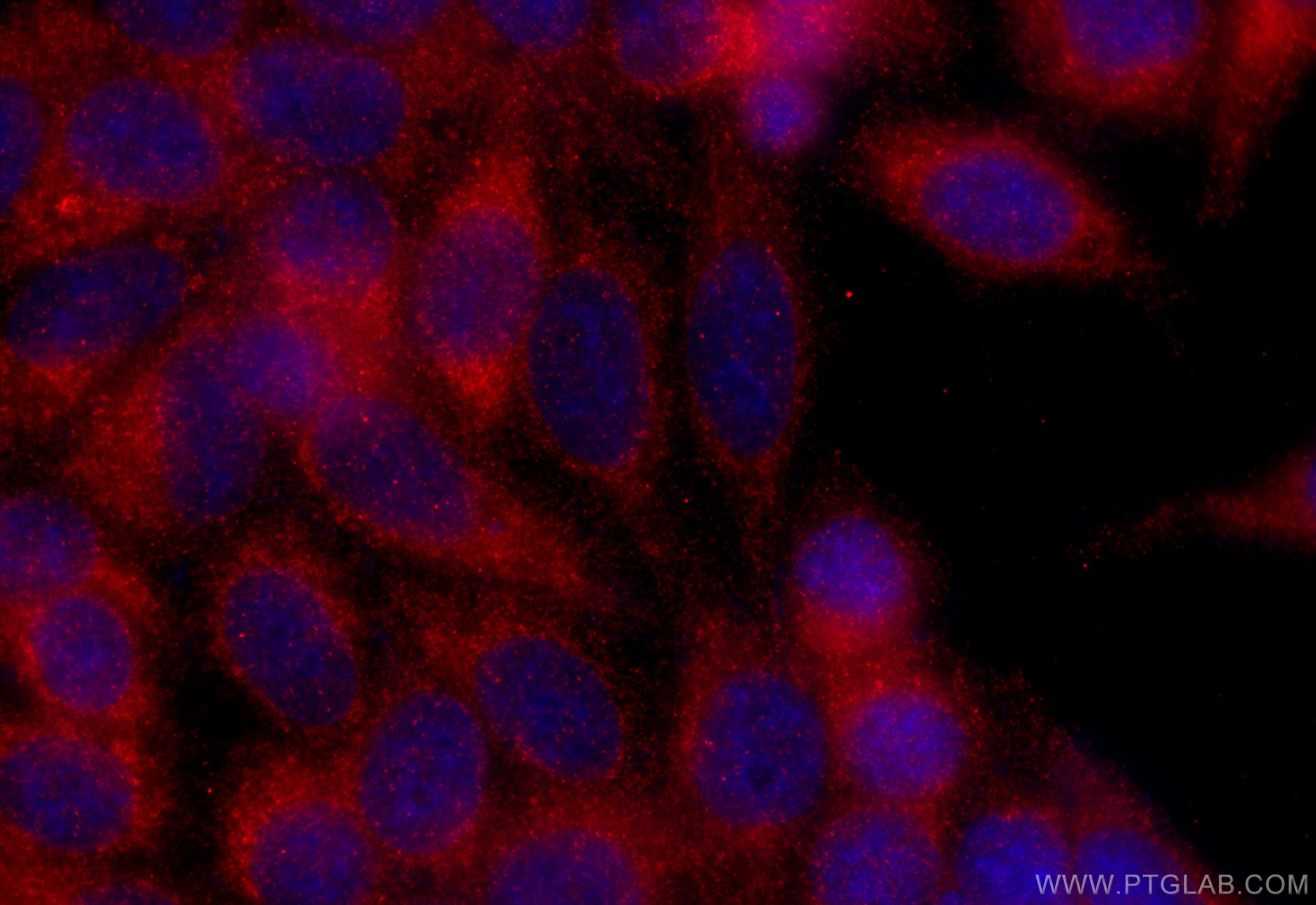 Immunofluorescence (IF) / fluorescent staining of HepG2 cells using CTNNA3 Polyclonal antibody (13974-1-AP)