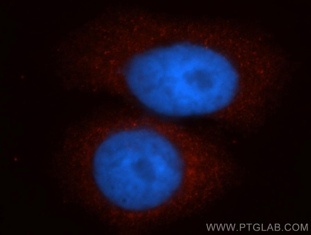 Immunofluorescence (IF) / fluorescent staining of HepG2 cells using CTNNA3 Polyclonal antibody (13974-1-AP)