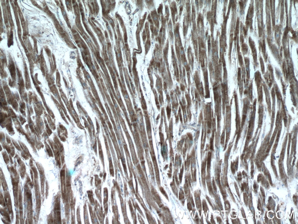 Immunohistochemistry (IHC) staining of human heart tissue using CTNNA3 Polyclonal antibody (13974-1-AP)