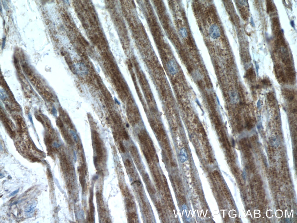 Immunohistochemistry (IHC) staining of human heart tissue using CTNNA3 Polyclonal antibody (13974-1-AP)