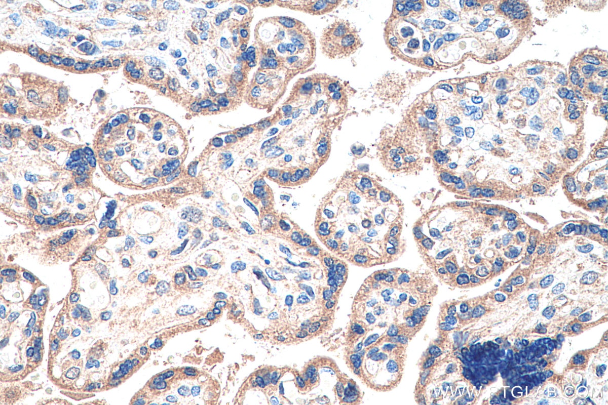 Immunohistochemistry (IHC) staining of human placenta tissue using CTNNA3 Polyclonal antibody (13974-1-AP)