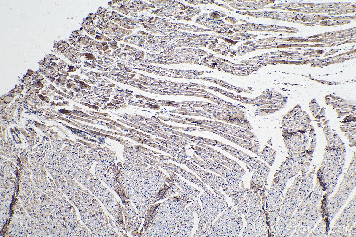 Immunohistochemistry (IHC) staining of mouse heart tissue using CTNNA3 Polyclonal antibody (13974-1-AP)