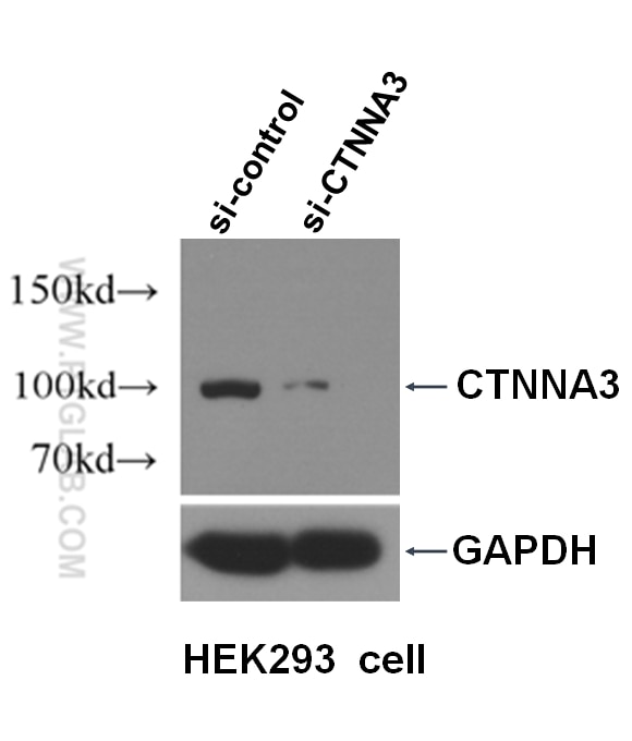 Western Blot (WB) analysis of HEK-293 cells using CTNNA3 Polyclonal antibody (13974-1-AP)