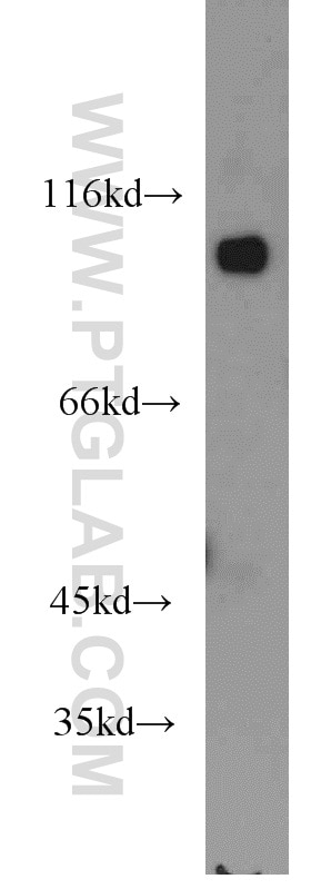 Western Blot (WB) analysis of mouse testis tissue using CTNNA3 Polyclonal antibody (13974-1-AP)