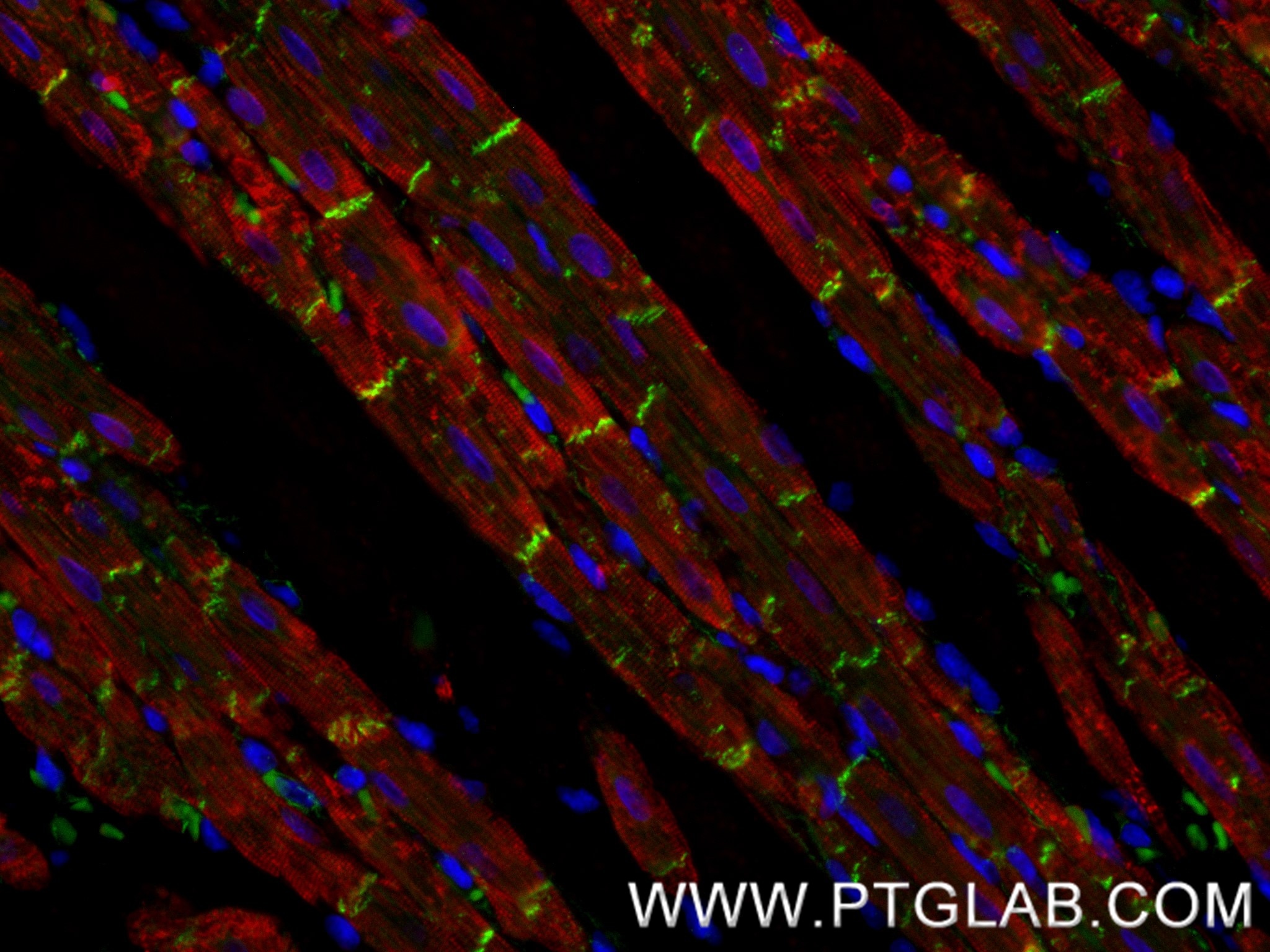 Immunofluorescence (IF) / fluorescent staining of rat heart tissue using CTNNA3 Recombinant monoclonal antibody (87022-1-RR)