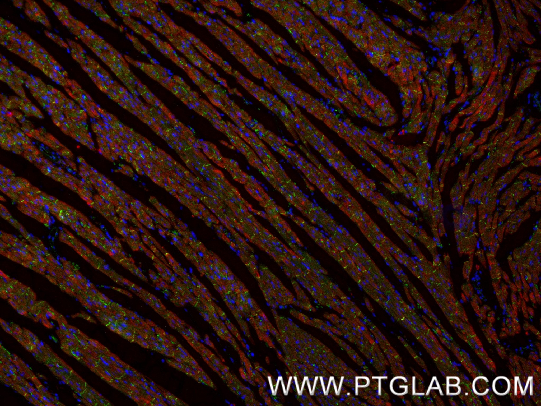Immunofluorescence (IF) / fluorescent staining of rat heart tissue using CTNNA3 Recombinant monoclonal antibody (87022-1-RR)