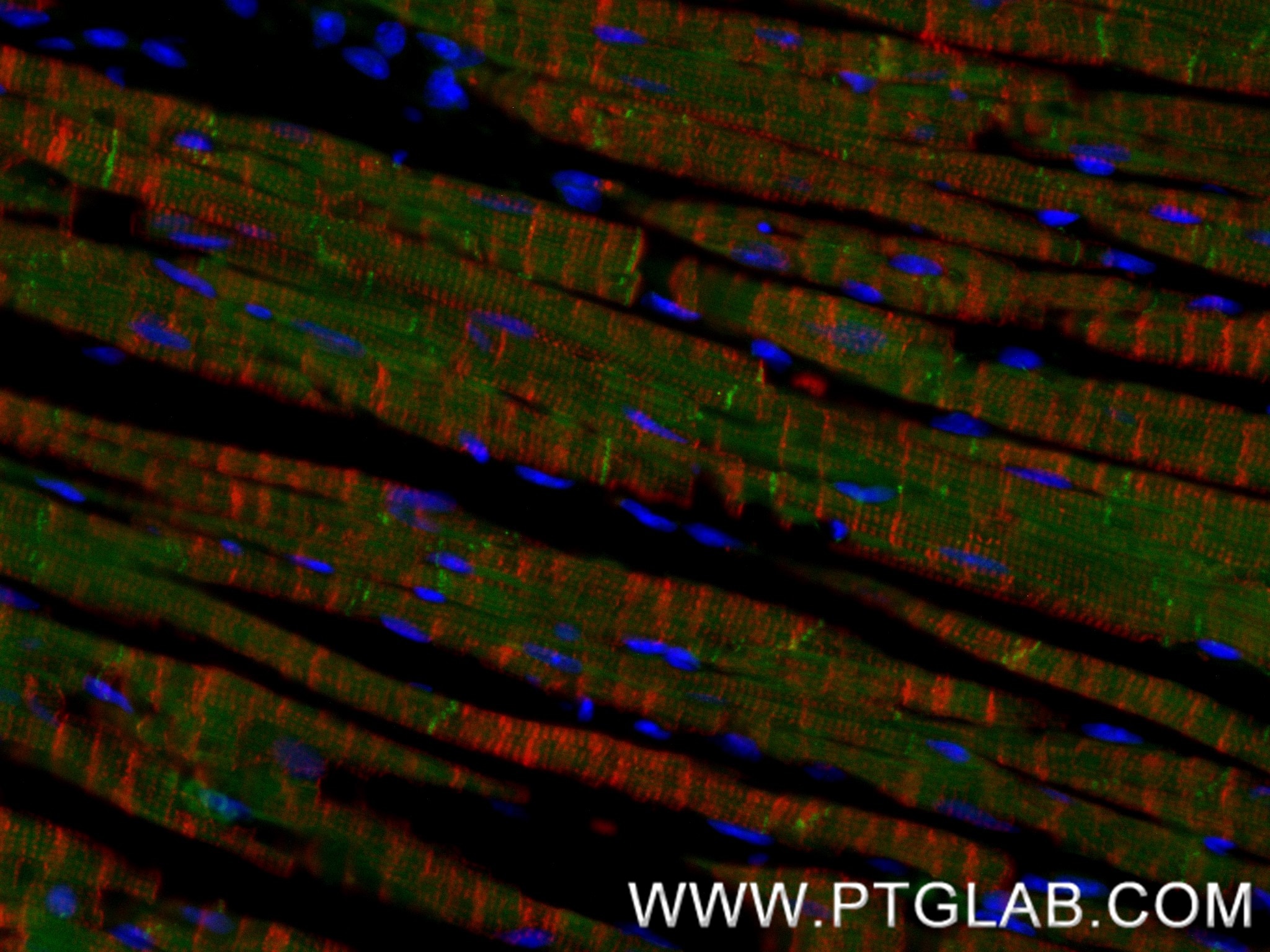 Immunofluorescence (IF) / fluorescent staining of mouse heart tissue using CTNNA3 Recombinant monoclonal antibody (87022-1-RR)