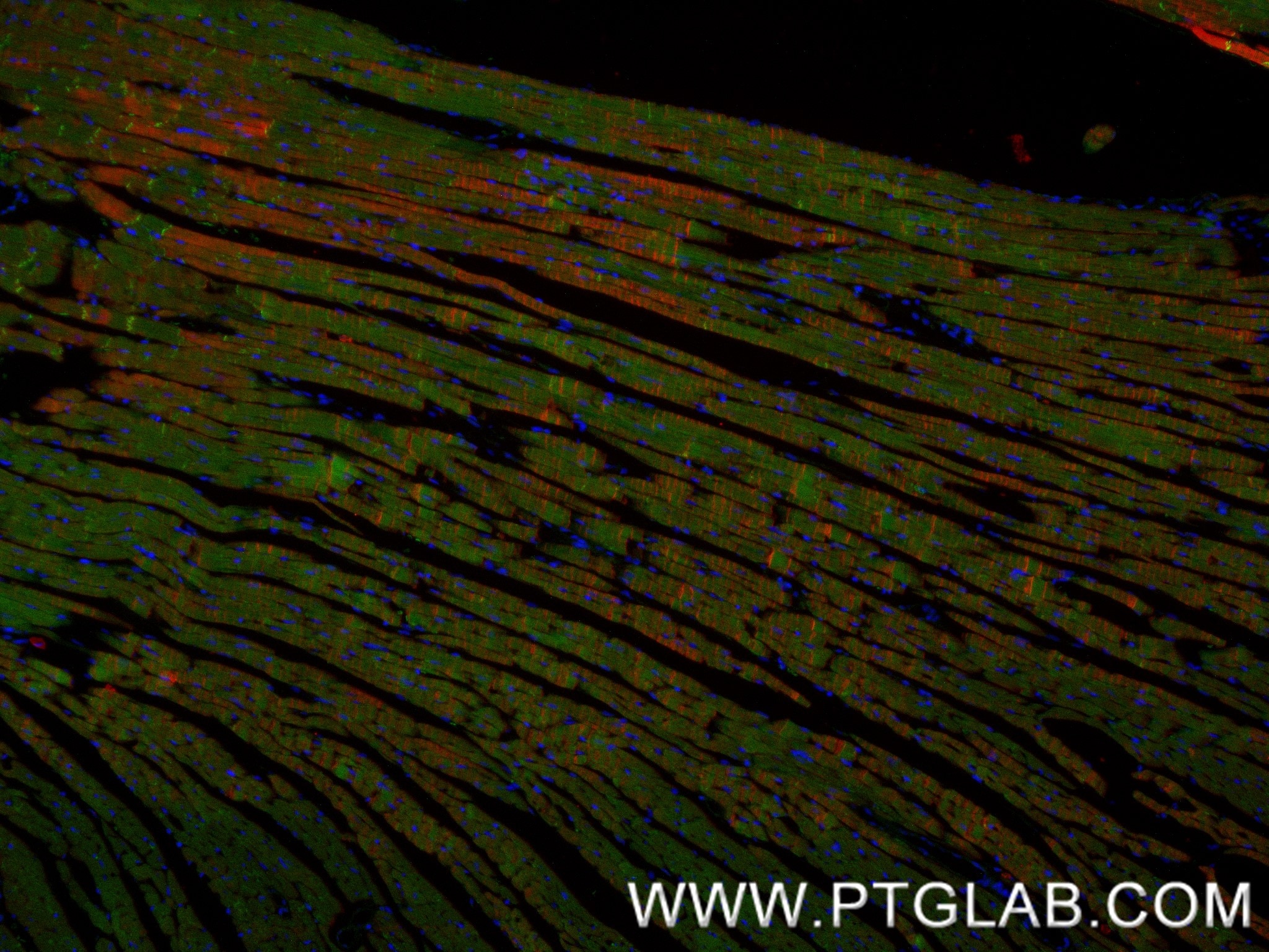 Immunofluorescence (IF) / fluorescent staining of mouse heart tissue using CTNNA3 Recombinant monoclonal antibody (87022-1-RR)