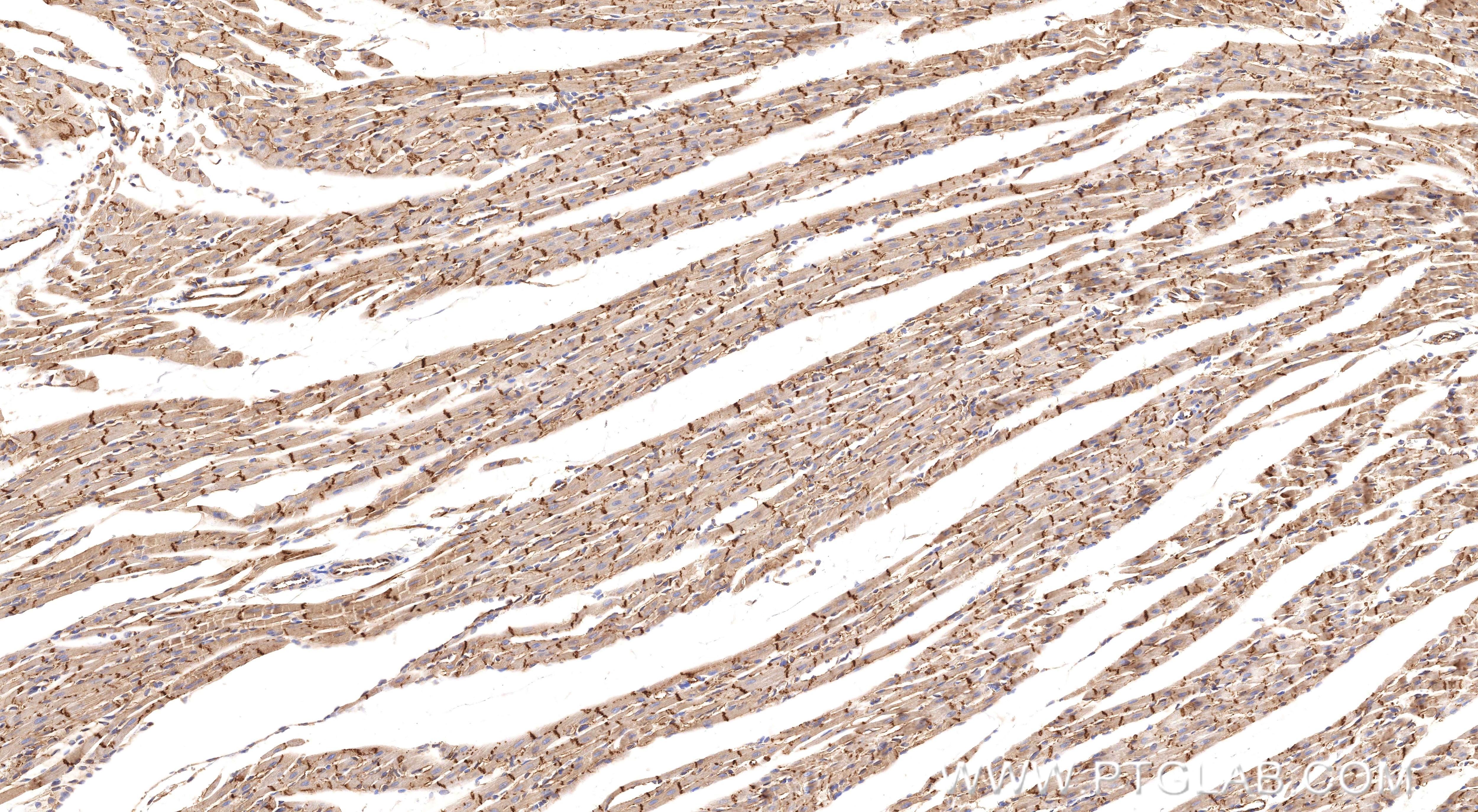 Immunohistochemistry (IHC) staining of rat heart tissue using CTNNA3 Recombinant monoclonal antibody (87022-1-RR)