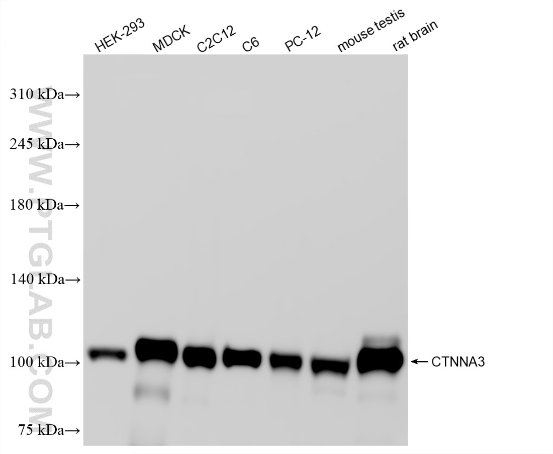 Western Blot (WB) analysis of various lysates using CTNNA3 Recombinant monoclonal antibody (87022-1-RR)