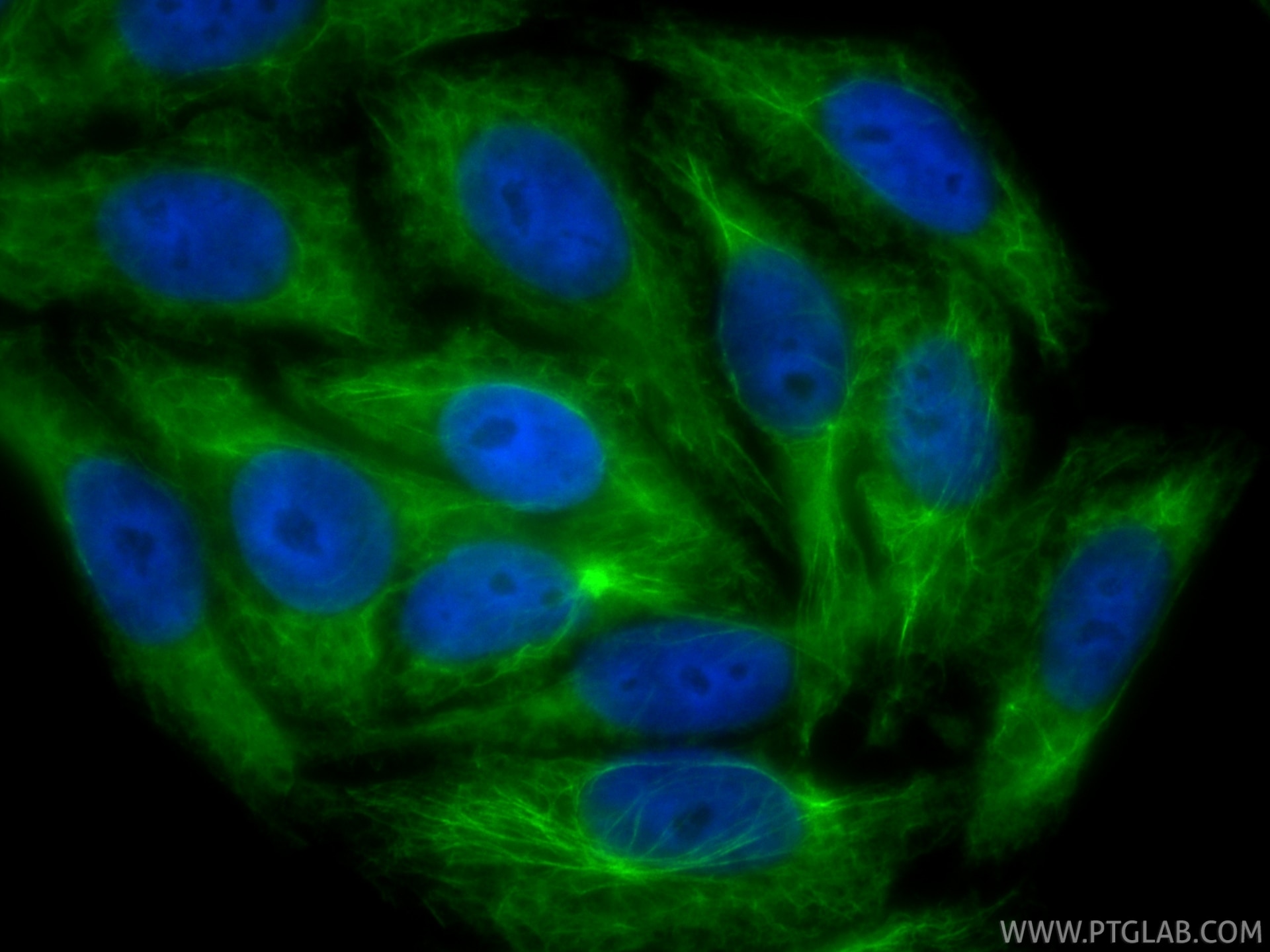 IF Staining of HepG2 using CL488-87022 Immunofluorescence (IF) / fluorescent staining of HepG2 cells using CoraLite® Plus 488-conjugated CTNNA3 Recombinant m (CL488-87022)