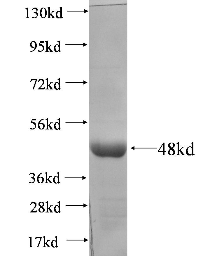 CTNNA3 fusion protein Ag5157 SDS-PAGE