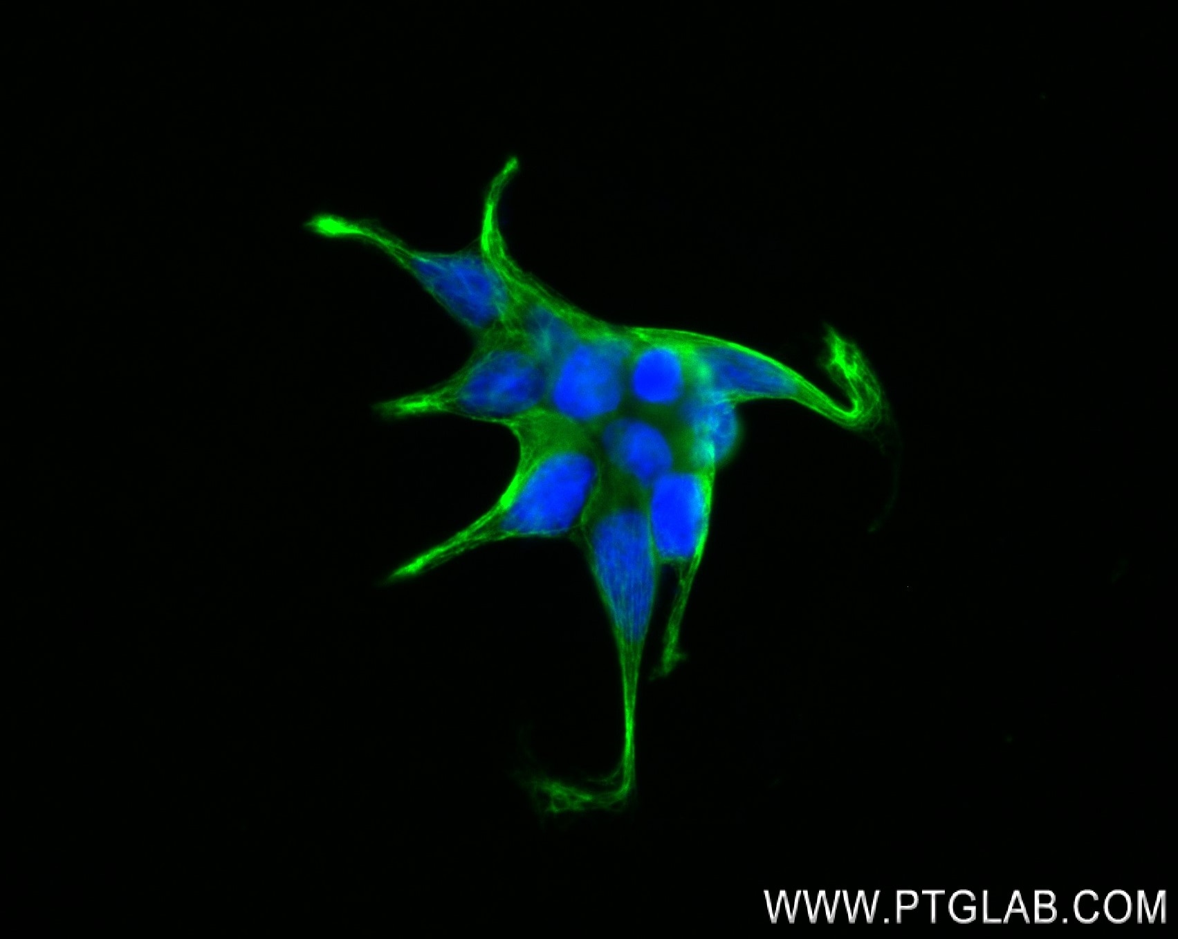 Immunofluorescence (IF) / fluorescent staining of LNCaP cells using CTNNAL1 Recombinant antibody (84052-1-RR)