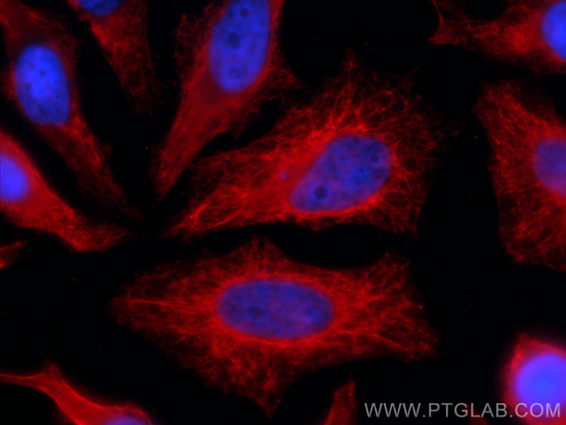 Immunofluorescence (IF) / fluorescent staining of HeLa cells using CTNNAL1 Recombinant antibody (84052-1-RR)