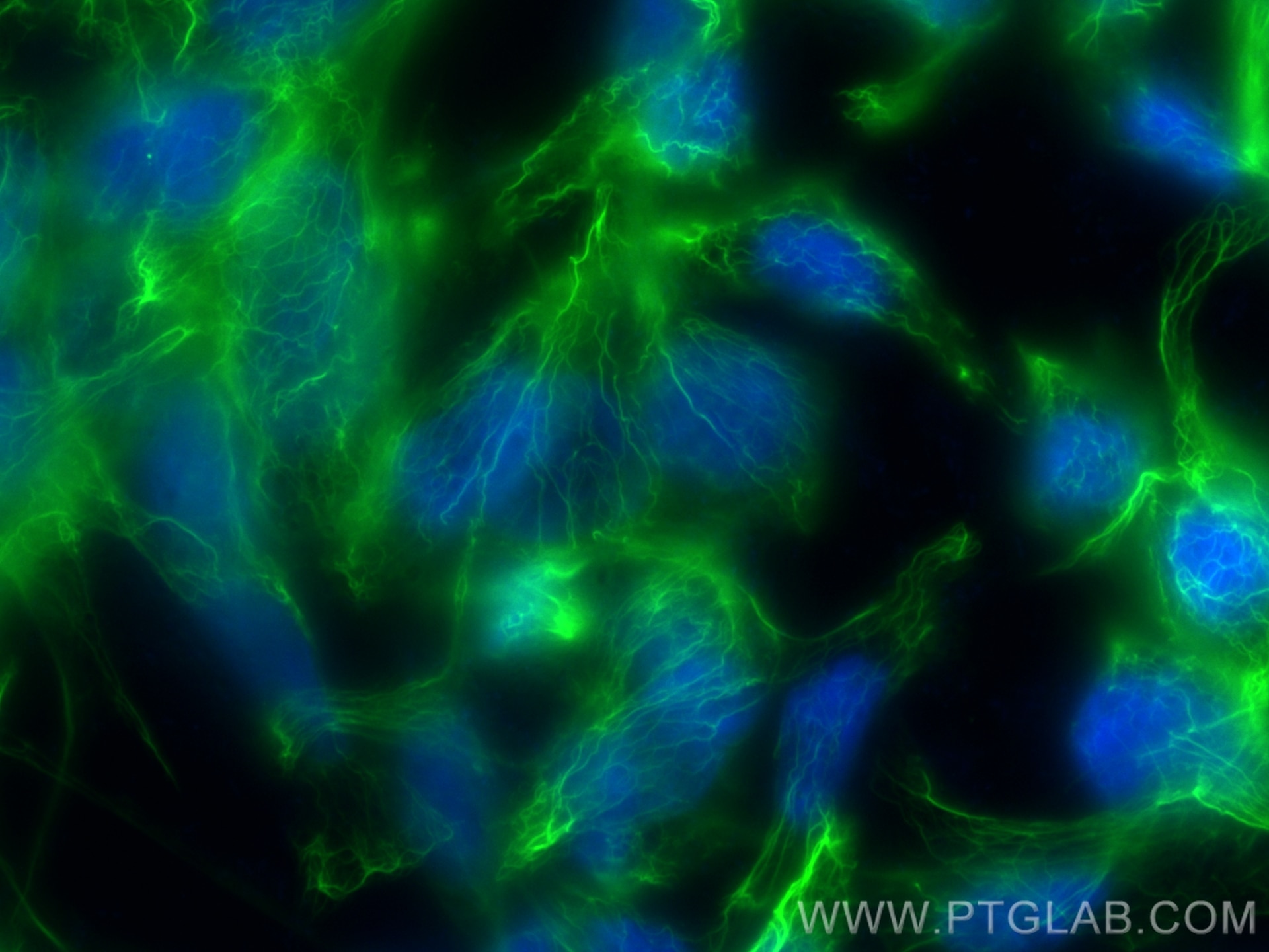 Immunofluorescence (IF) / fluorescent staining of LNCaP cells using CoraLite® Plus 488-conjugated CTNNAL1 Recombinant  (CL488-84052)