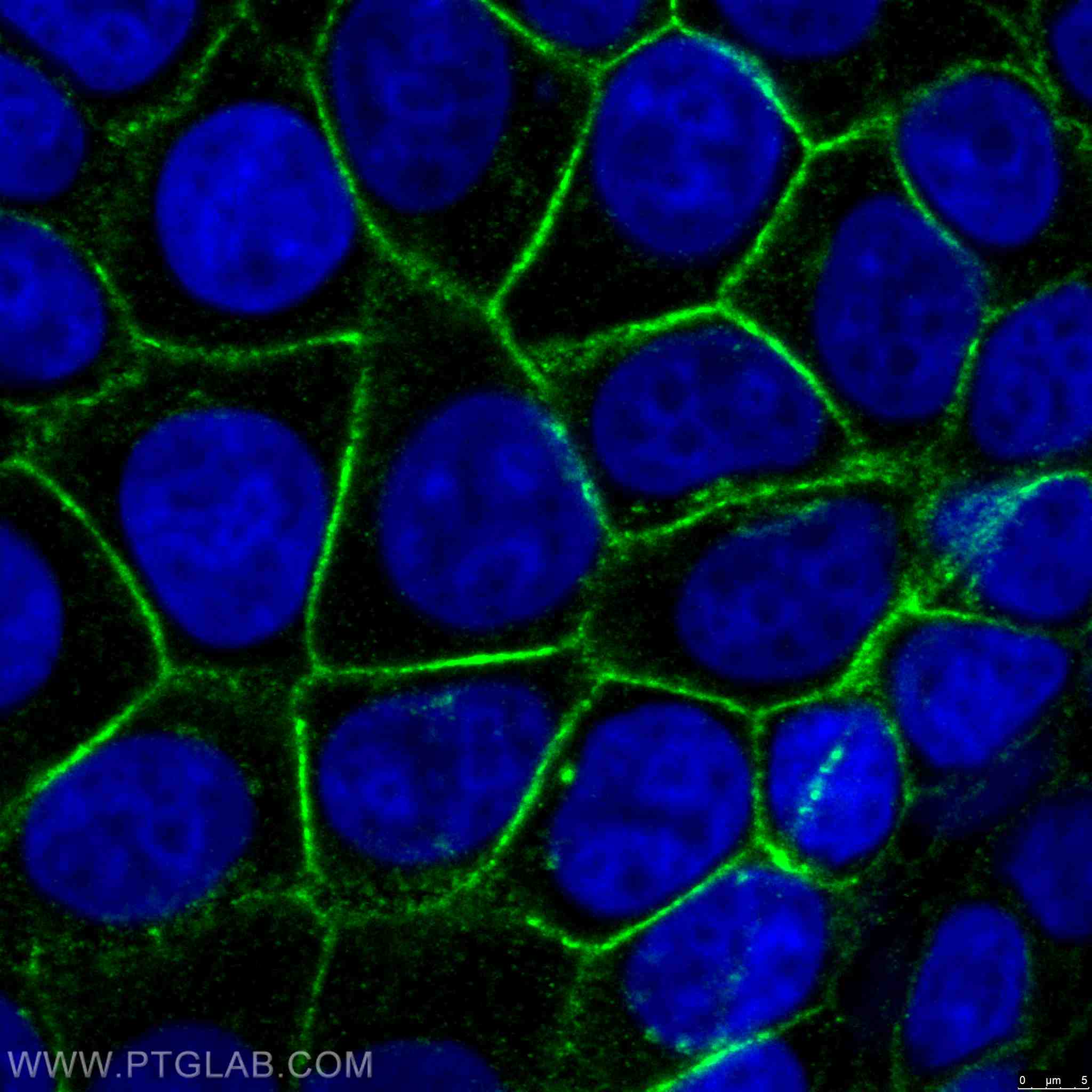 Immunofluorescence (IF) / fluorescent staining of MCF-7 cells using Beta Catenin Monoclonal antibody (66379-1-Ig)