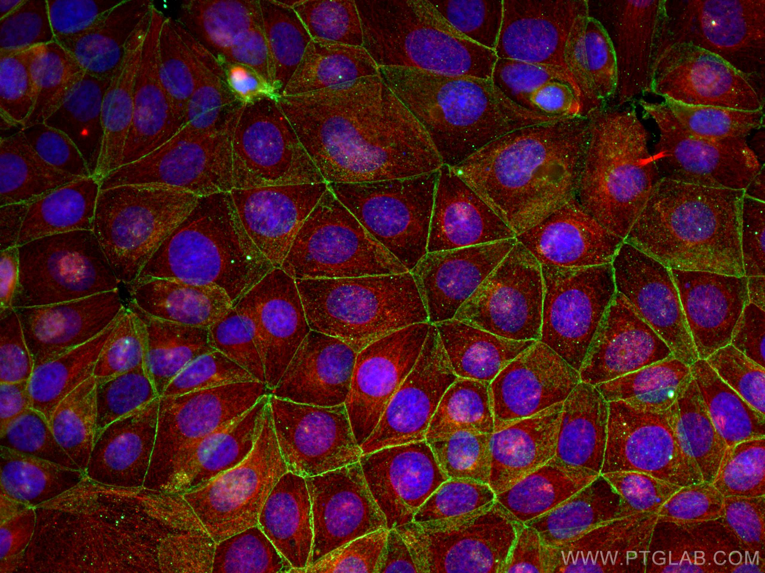 Immunofluorescence (IF) / fluorescent staining of MCF-7 cells using Beta Catenin Monoclonal antibody (66379-1-Ig)