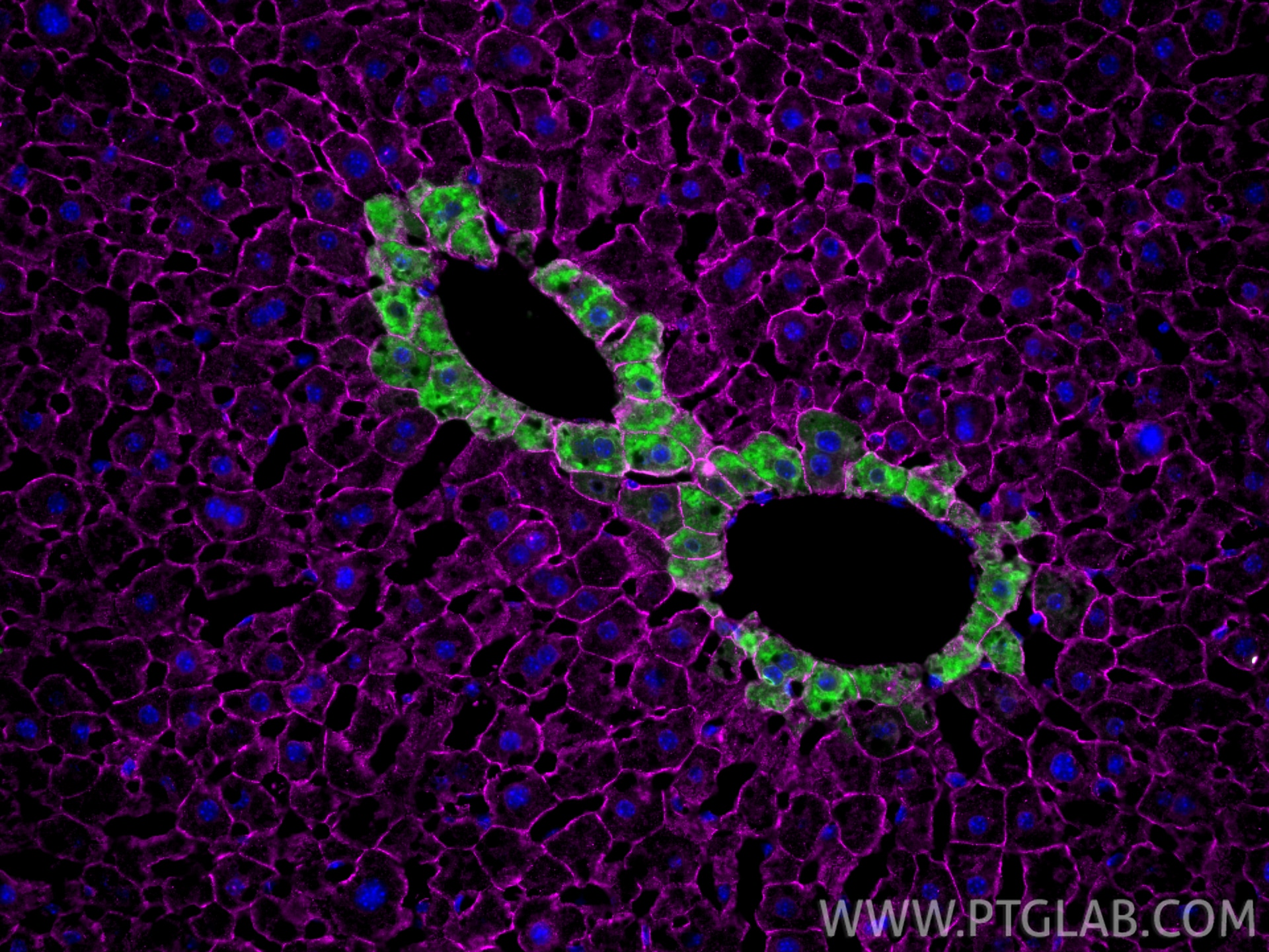 IF Staining of mouse liver using 66379-1-Ig (same clone as 66379-1-PBS) Immunofluorescence (IF) / fluorescent staining of mouse liver tissue using Beta Catenin Monoclonal antibody (66379-1-Ig)