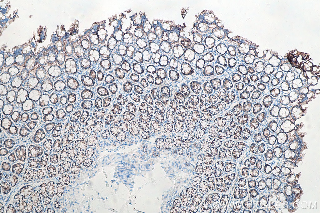 IHC staining of rat colon using 66379-1-Ig (same clone as 66379-1-PBS) Immunohistochemistry (IHC) staining of rat colon tissue using Beta Catenin Monoclonal antibody (66379-1-Ig)