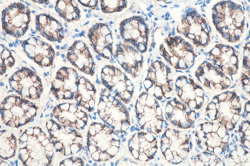Immunohistochemistry (IHC) staining of rat colon tissue using Beta Catenin Monoclonal antibody (66379-1-Ig)