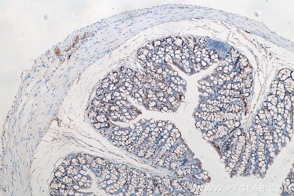 IHC staining of mouse colon using 66379-1-Ig (same clone as 66379-1-PBS) Immunohistochemistry (IHC) staining of mouse colon tissue using Beta Catenin Monoclonal antibody (66379-1-Ig)
