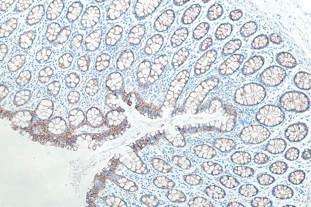 Immunohistochemistry (IHC) staining of human colon tissue using Beta Catenin Monoclonal antibody (66379-1-Ig)